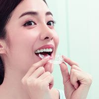 インビザライン とりはずし写真